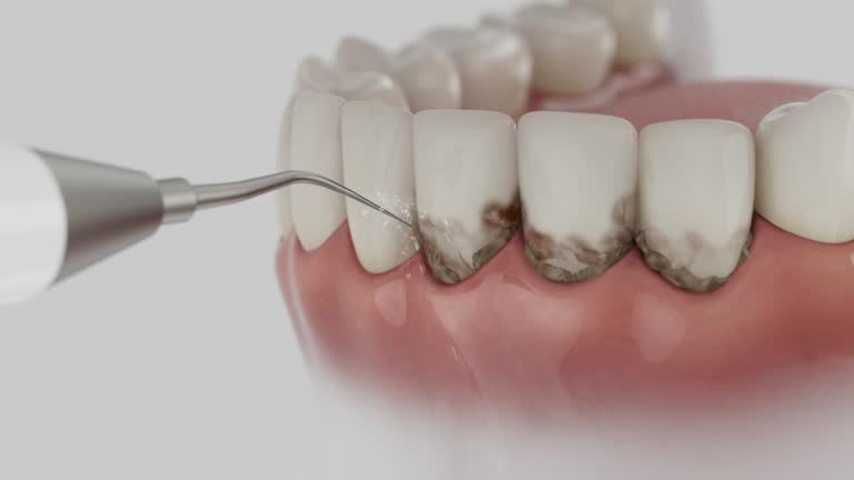 Trusted Wisdom Tooth Removal service in Throop, PA - Dentist Open Now